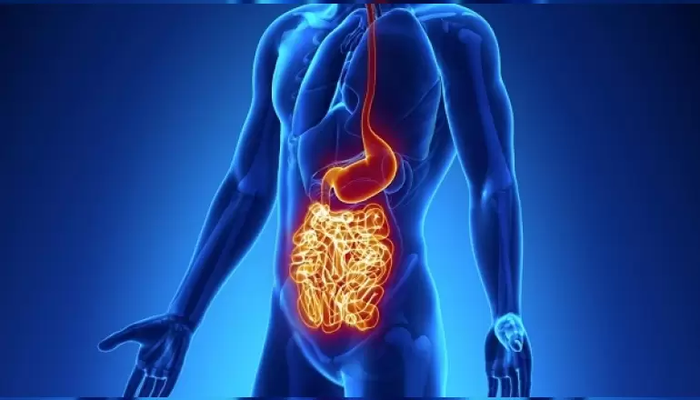 Crohn Hastalığı