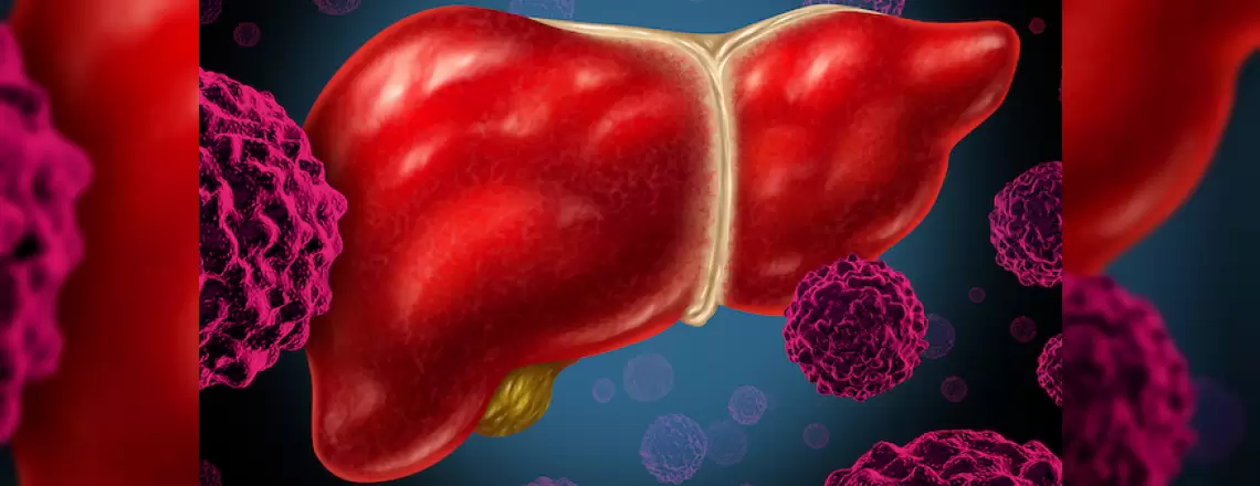 İrritabl Barsak Hastalığı (Spastik Kolon)