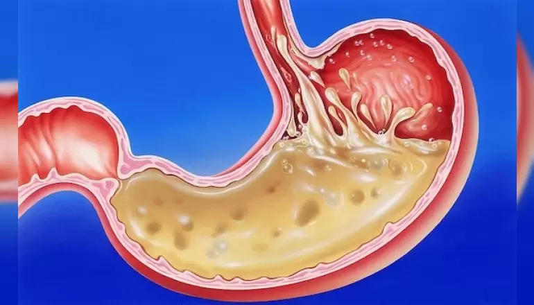 mide-barsak-hastaliklari-ve-kolon-kanseri