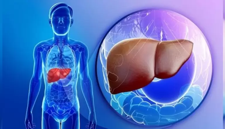 primer-biliyer-siroz