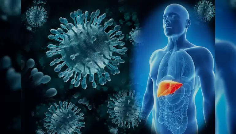 viral-hepatitler-sarilik