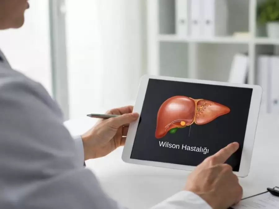 wilson-hastaligi