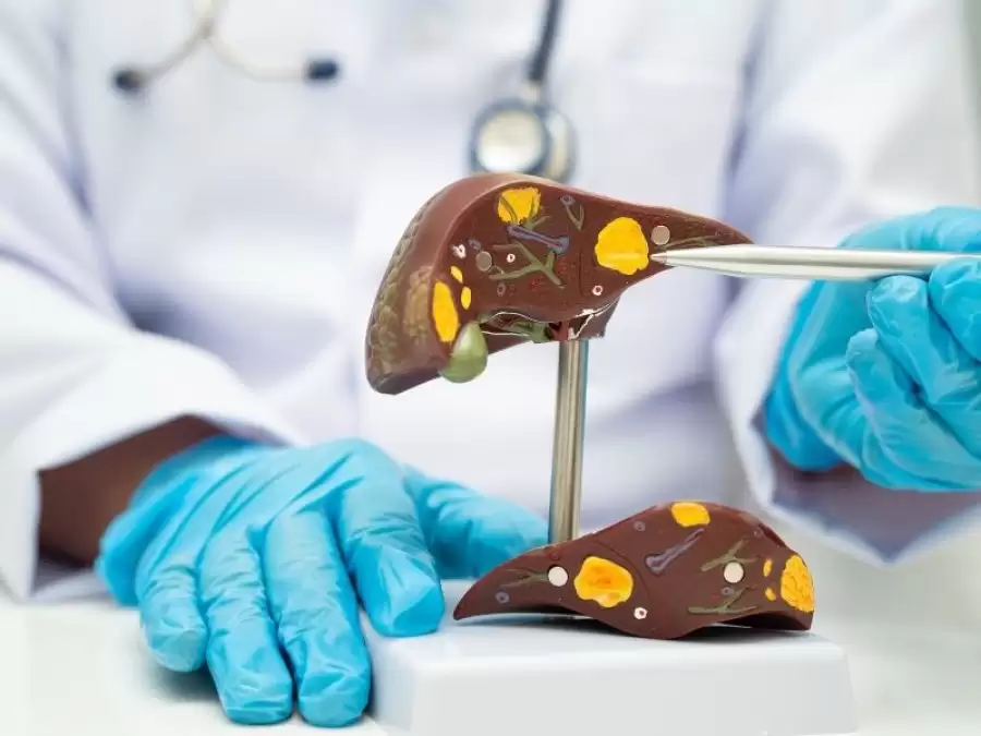 yagli-karaciger-hastaligi